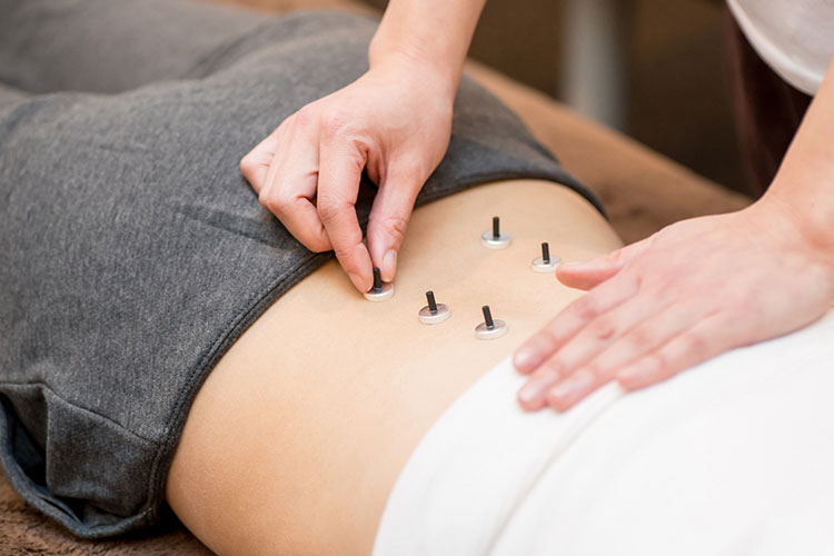 鍼灸・マッサージイメージ