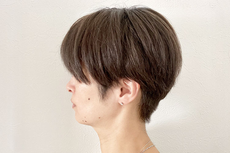 ほくろイメージ